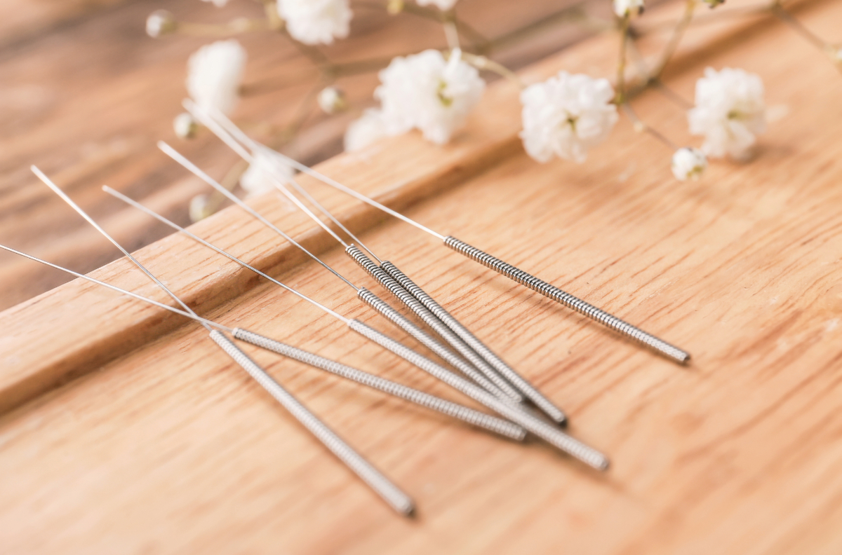 Acupuncture Image